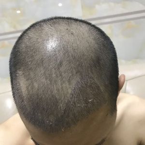 发际线分享社区
