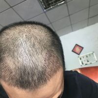 發(fā)際線用戶圖片