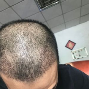 发际线分享社区