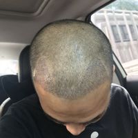 發(fā)際線用戶圖片