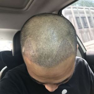发际线分享社区
