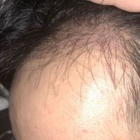 發(fā)際線用戶圖片