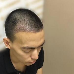 发际线分享社区
