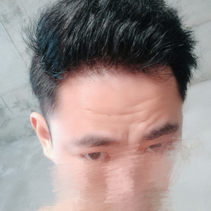 发际线分享社区