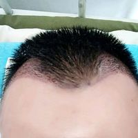 發(fā)際線用戶圖片