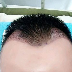 发际线分享社区