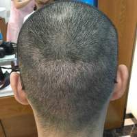 發(fā)際線用戶圖片