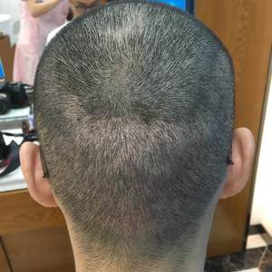 发际线分享社区