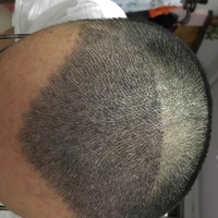 發(fā)際線用戶圖片