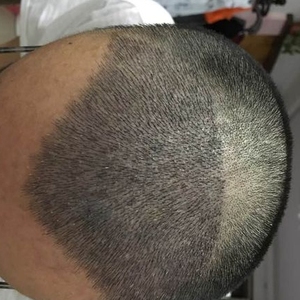 发际线分享社区