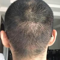 發(fā)際線用戶圖片