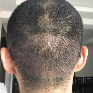 发际线分享社区