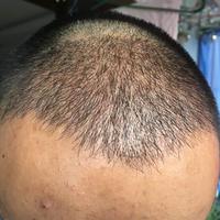 發(fā)際線用戶圖片