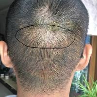 發(fā)際線用戶圖片