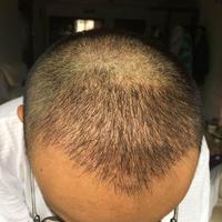 發(fā)際線用戶圖片