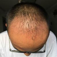 發(fā)際線用戶圖片