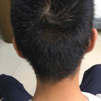 發(fā)際線用戶圖片