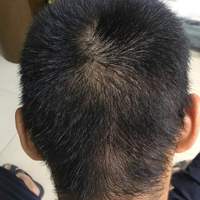發(fā)際線用戶圖片
