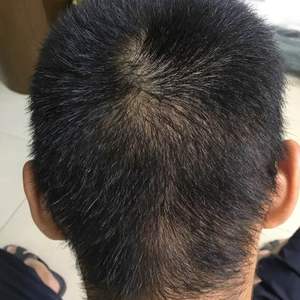 发际线分享社区