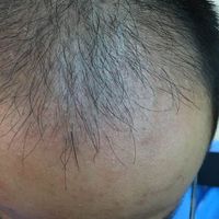 發(fā)際線用戶圖片