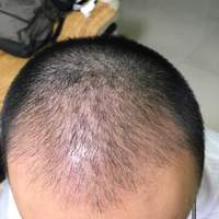 發(fā)際線用戶圖片