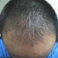 發(fā)際線用戶圖片