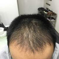 發(fā)際線用戶圖片