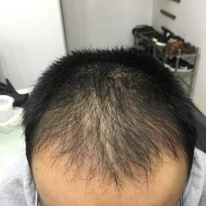 发际线分享社区