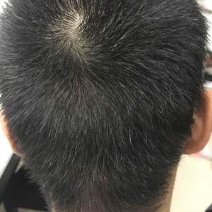 发际线分享社区