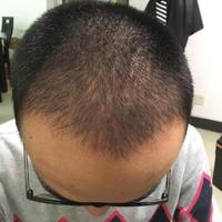 發(fā)際線用戶圖片