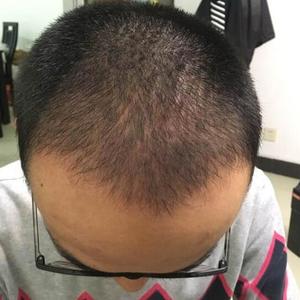 发际线分享社区