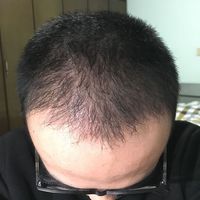 發(fā)際線用戶圖片