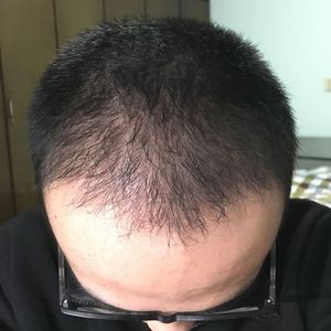 发际线分享社区
