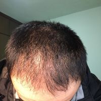 發(fā)際線用戶圖片