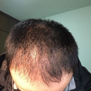 发际线分享社区