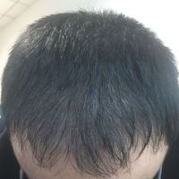 發(fā)際線用戶圖片