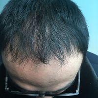 發(fā)際線用戶圖片
