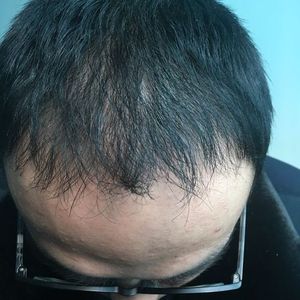 发际线分享社区