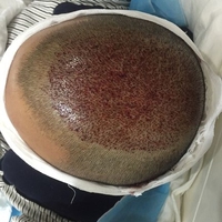 禿頂用戶圖片