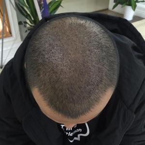 发际线分享社区