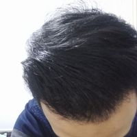 發(fā)際線用戶圖片