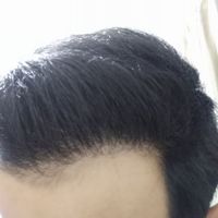 發(fā)際線用戶圖片