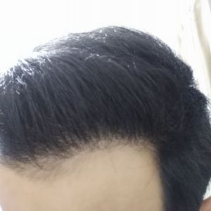 发际线分享社区