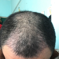 禿頂用戶圖片
