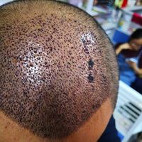 發(fā)際線用戶圖片