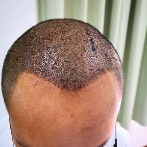 发际线分享社区