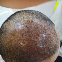 發(fā)際線用戶圖片