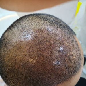发际线分享社区
