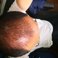 發(fā)際線用戶圖片