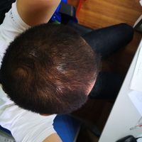發(fā)際線用戶圖片